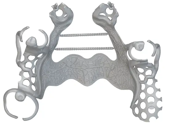 Removable Partial Denture (RPD) Framework Lattice Prop Generation
