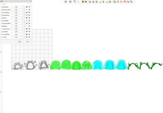 Removable Partial Denture (RPD) Framework Orientation Optimization